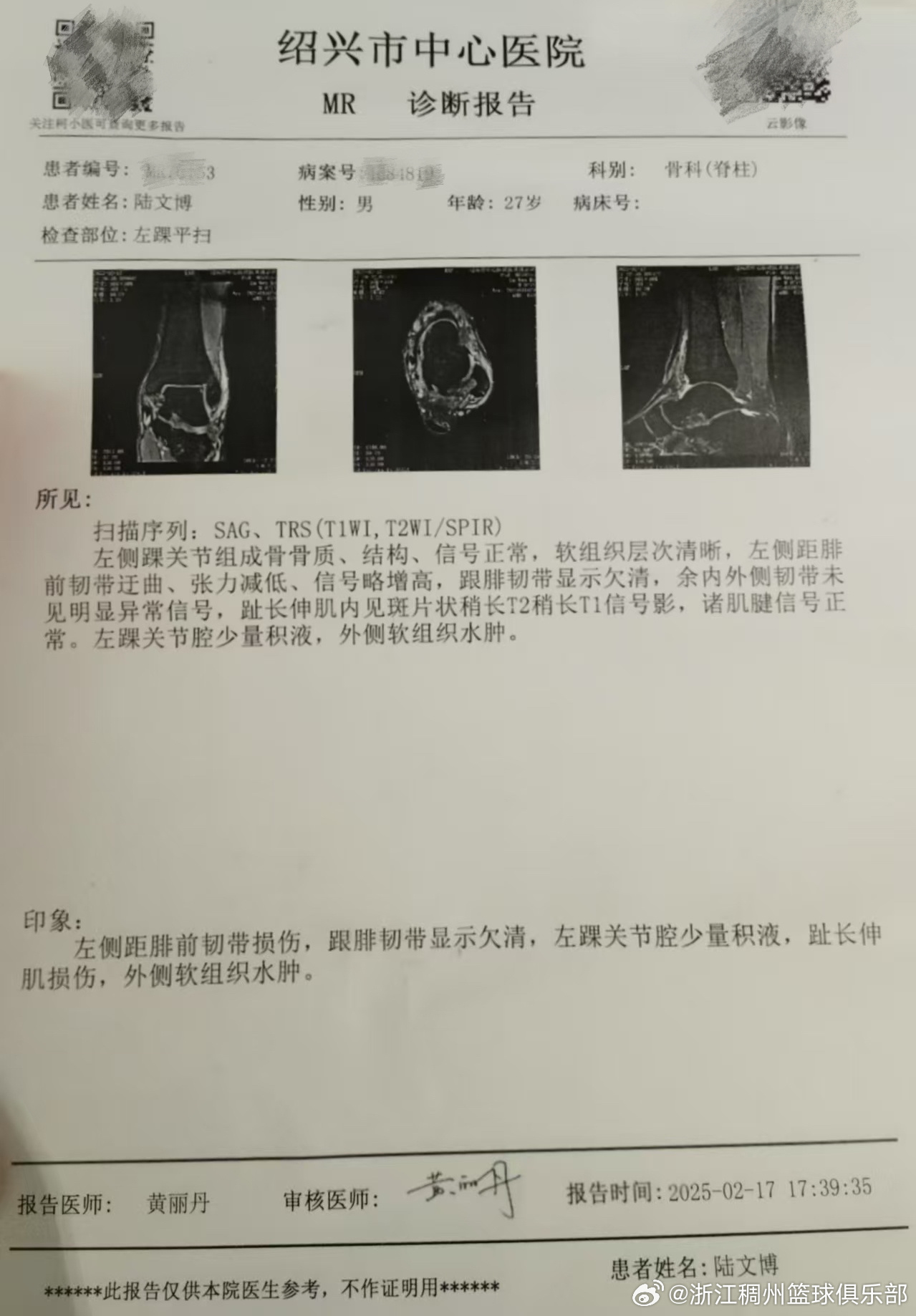额的转会费